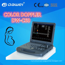 DAWEI DW-C60PLUS Portable Color Doppler Ultrasound CE ISO